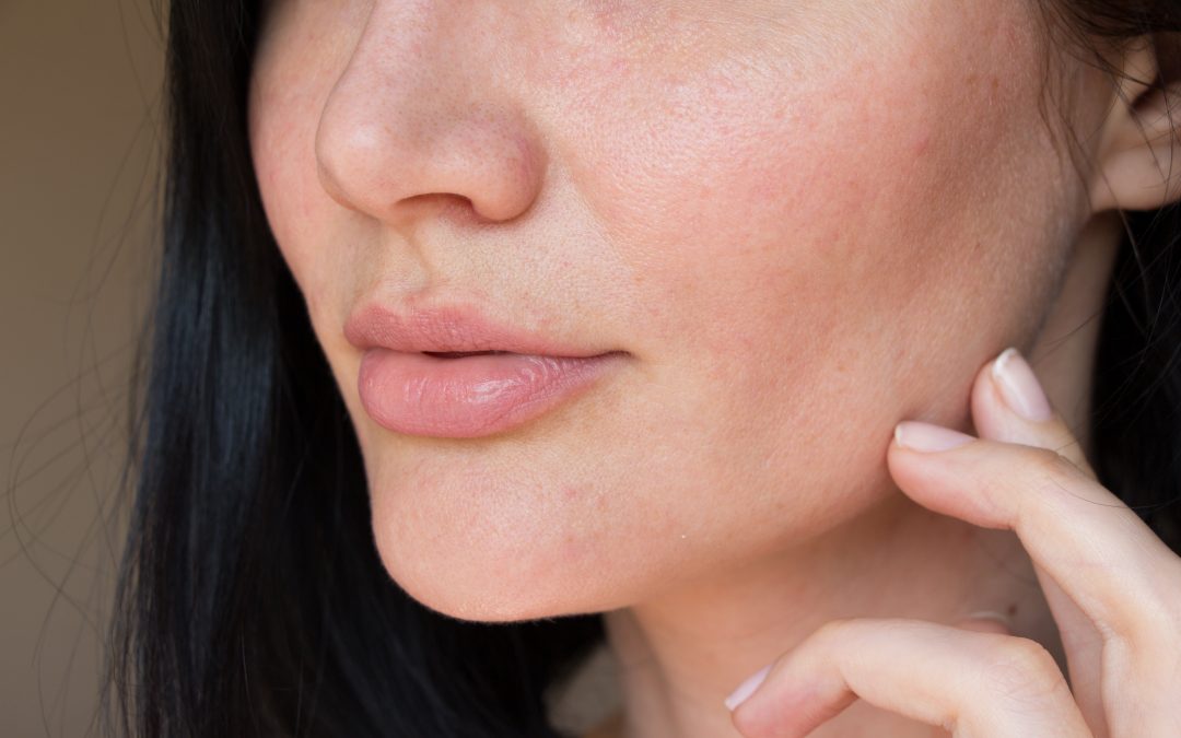 Fighting Dry Skin This Spring