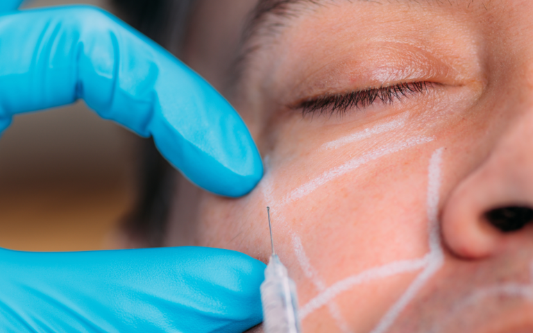 The Growing Interest of Men in Aesthetic Treatments A New Era of Self-Care at Cosmetier